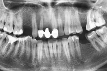 radiografias odontologicas